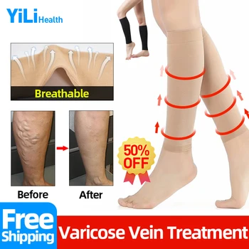 Varice Șosete Tratamentul Varicelor Angiitis Flebită Picior Vasculita Grijă Ciorapi Dresuri Pentru A Promova Circulația Sanguină